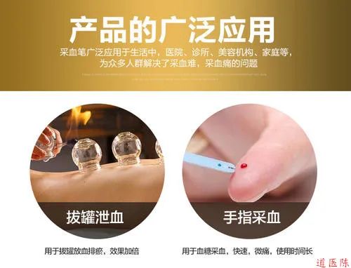 Bloodletting Therapy in Traditional Chinese Medicine: A Pathway to Healing