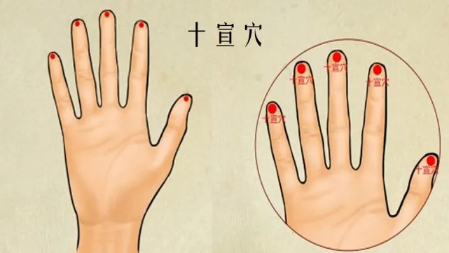 The Unique Treatment of Bloodletting in Traditional Chinese Medicine