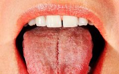 Nine Tongue Signs Indicating Qi Deficiency: Timely Adjustment and Medical Attention Recommended