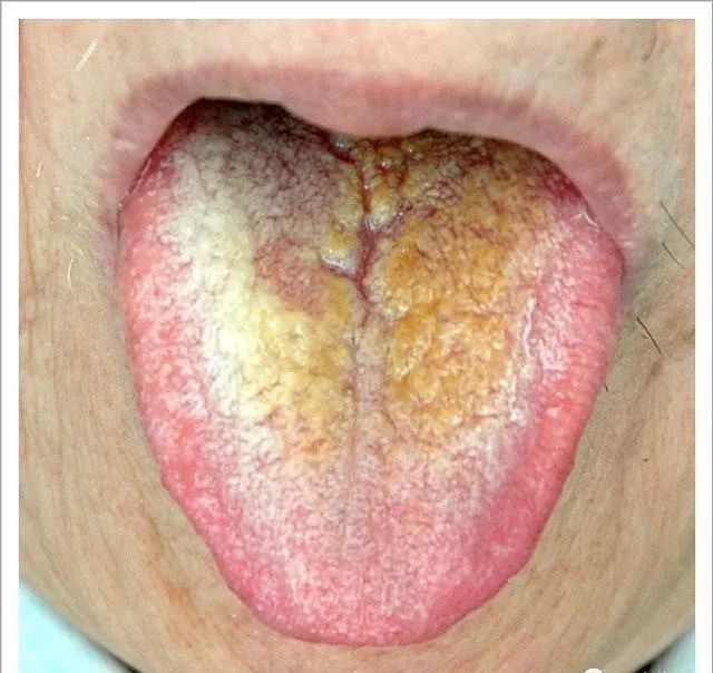 Traditional Chinese Medicine Tongue Diagnosis: 26 Clinical High-Definition Tongue Diagnosis Images with Analysis