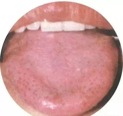 130 High-Definition Tongue Diagnosis Charts (Recommended for Collection)