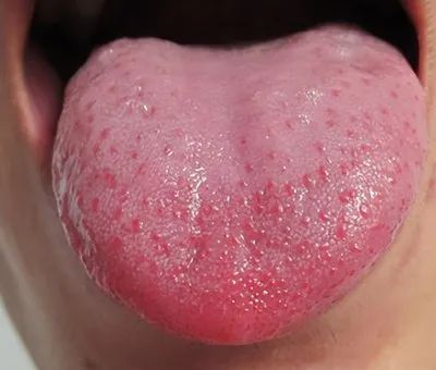 Common Types of Yin Deficiency and How to Regulate Them