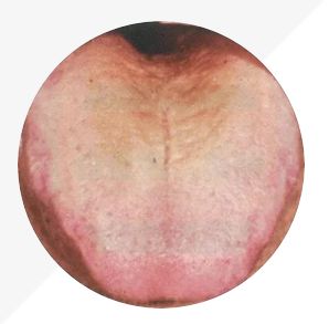 Understanding Tongue Diagnosis in TCM: Insights into Health from Tongue Appearance (Part 2)