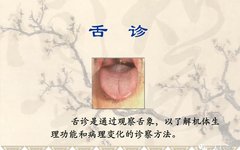 Tongue Diagnosis in Traditional Chinese Medicine