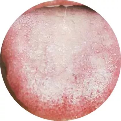 Comprehensive Guide to Tongue Diagnosis: A Must-Collect!