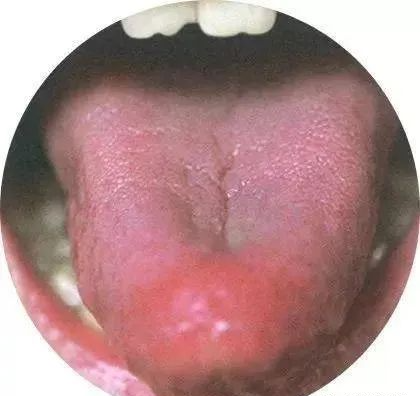 130 High-Definition Tongue Diagnosis Charts (Recommended for Collection)