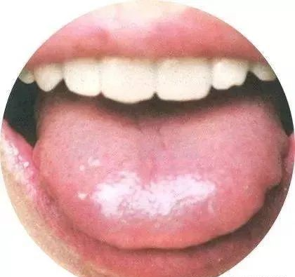 130 High-Definition Tongue Diagnosis Charts (Recommended for Collection)