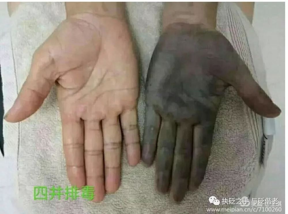 Black Sha: The Surprising Discovery of Copper Gua Sha