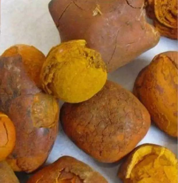 Two Types of Pills for Detoxification and Blood Stasis Removal! Treating Thyroid Tumors, Breast Cancer, and More