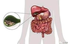 The Six Fu Organs: Gallbladder, Stomach, Small Intestine, Large Intestine, Bladder, and San Jiao