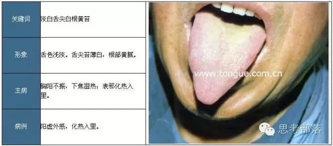 Comprehensive Guide to Tongue Diagnosis (8): 72 Types of Tongue Diagnosis Charts
