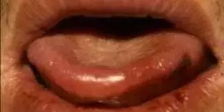 The Most Comprehensive Guide to Tongue Diagnosis! Master It and Become a Tongue Diagnosis Expert