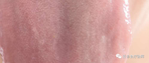 Distinguishing Between Yang Deficiency and Blood Deficiency with Pale Tongue