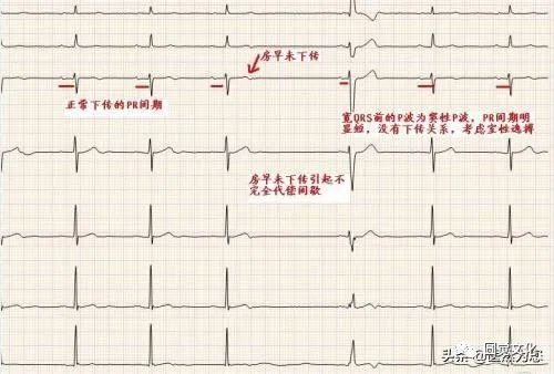 Understanding Pulse Patterns: Xu Mai, Wei Mai, Xi Mai, Dai Mai, and Duan Mai Explained for Everyone