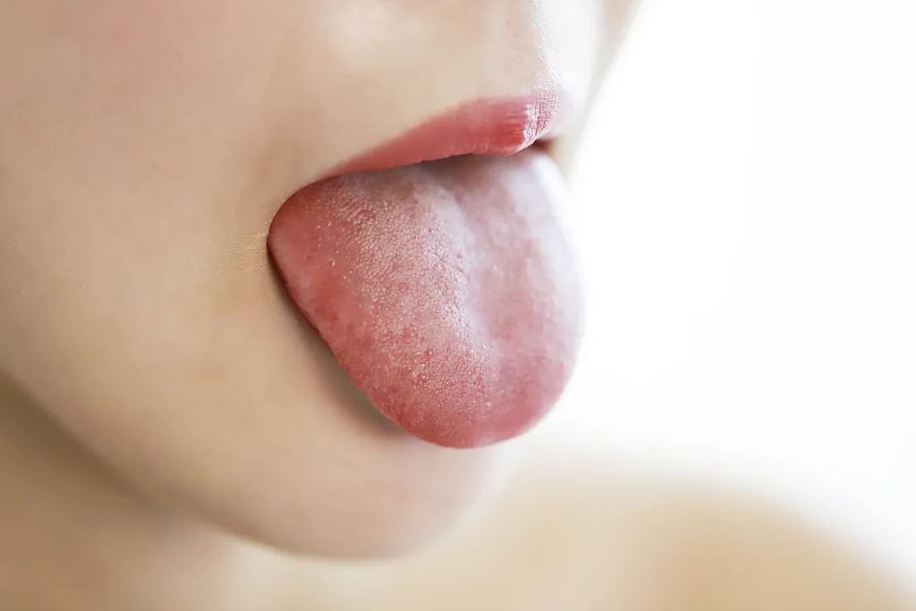 Is a Clean Tongue Always Better? Wrong! It May Indicate You Are 'Suffering from Illness'! A Healthy Tongue Actually Looks Like This...