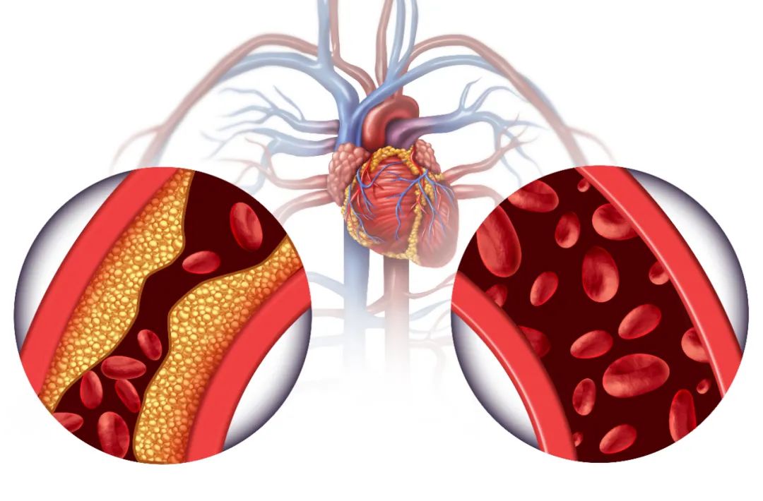 9 Points to Self-Check for Qi Stagnation and Blood Stasis: Are You Affected?