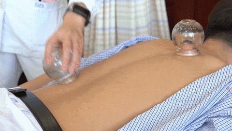 Traditional Chinese Medicine Techniques: Spring Fatigue Relief with Balancing Cupping