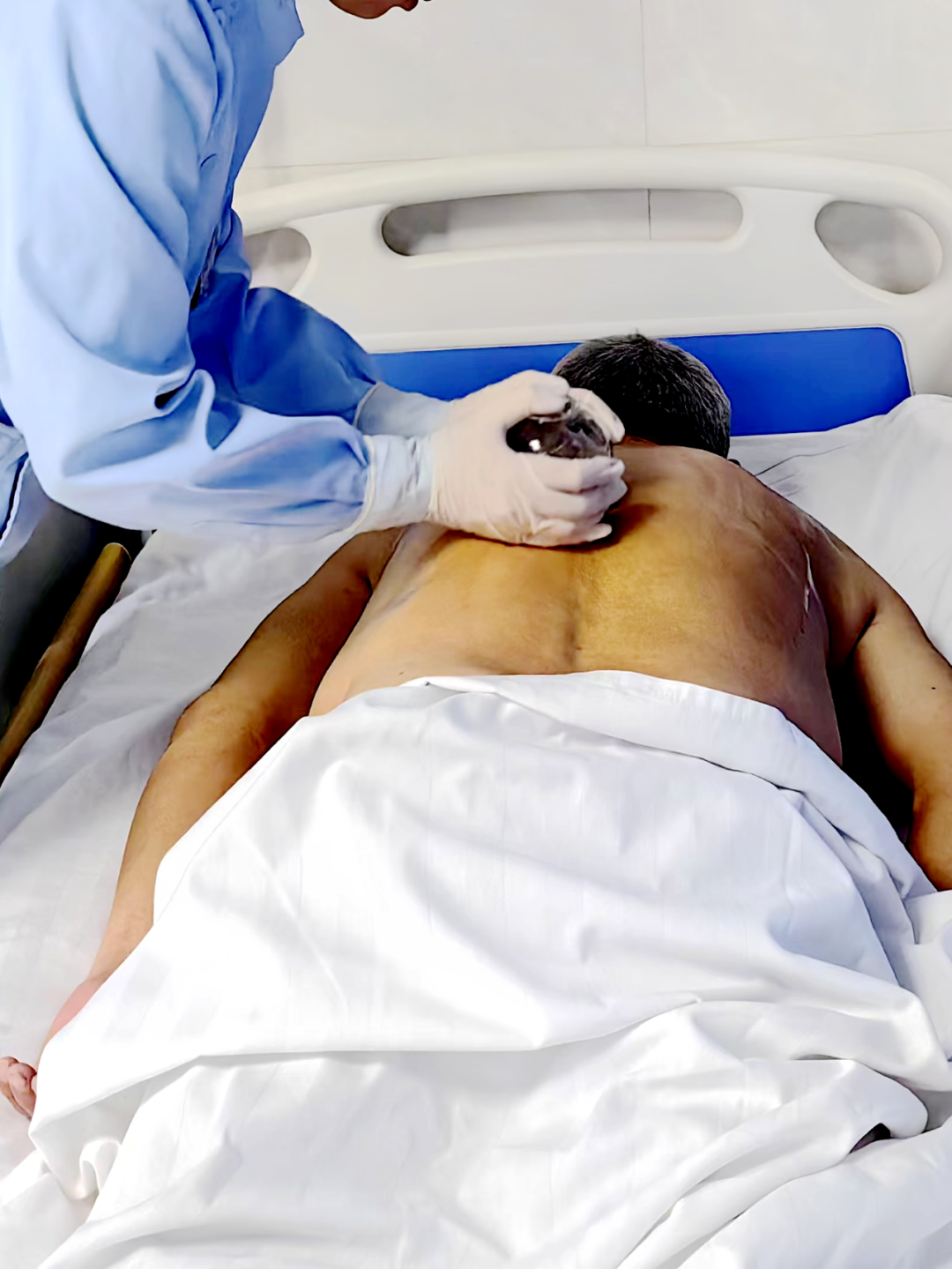 Balancing Cupping Therapy: Aiding Recovery for Cerebrovascular Disease Patients