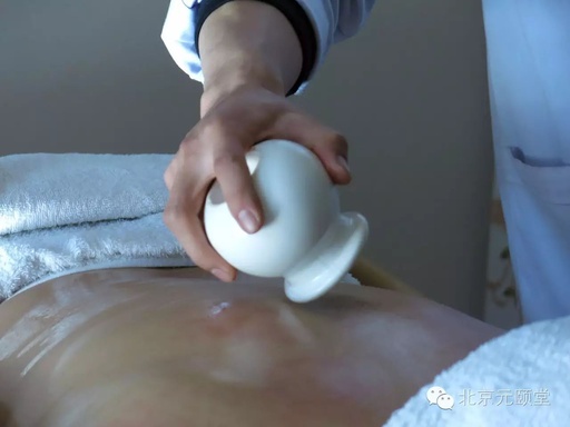 Benefits of Cupping Therapy on the Back