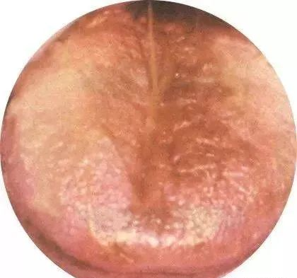 130 High-Definition Tongue Diagnosis Charts (Recommended for Collection)