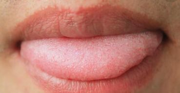 Comprehensive Tongue Diagnosis Guide