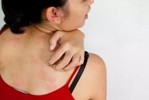 Why Can a Tiny Silver Needle Suppress Tumors? Experts Reveal the Secrets of 'Needles and Fire'!