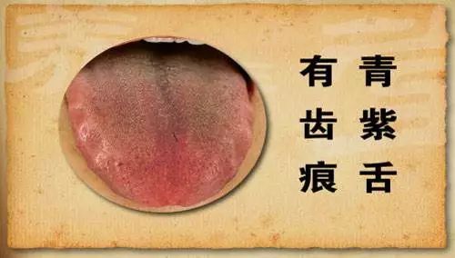 The TCM Tongue Diagnosis Atlas is Here! Observe the Tongue to Understand the Whole Body!