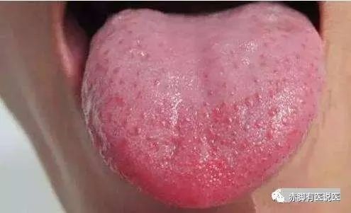 Understanding Your Tongue Diagnosis in 10 Minutes