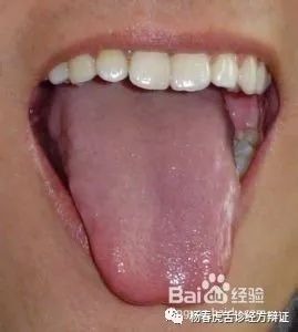 Foundations of Traditional Chinese Medicine: Phlegm-Dampness