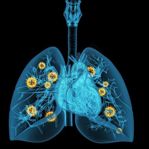 Fu Zheng Qu Xie Formula: A Clinical Study on Preventing Recurrence and Metastasis of Early-Stage Lung Adenocarcinoma