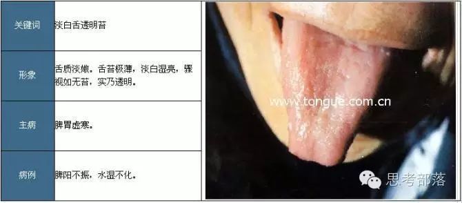 Comprehensive Guide to Tongue Diagnosis (8): 72 Types of Tongue Diagnosis Charts