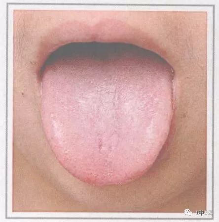 Learning Tongue Diagnosis from Scratch: Part 3 - Tongue Color