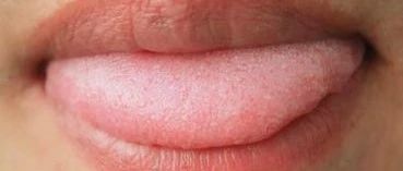 A Comprehensive Guide to Tongue Diagnosis in Traditional Chinese Medicine