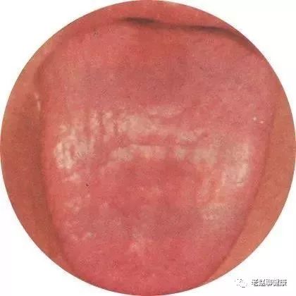 What Can Tongue Quality and Coating Reveal? The Significance of Tongue Diagnosis