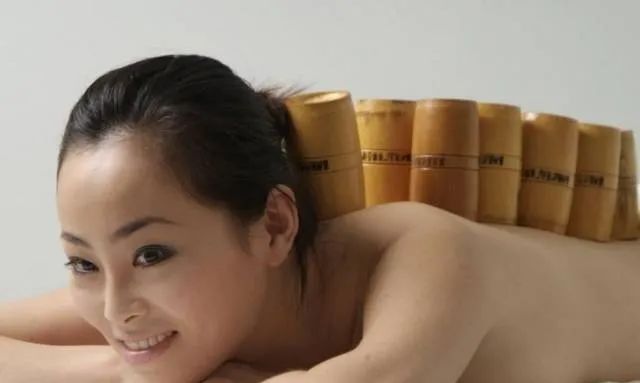 Cupping Therapy in Traditional Chinese Medicine: Meaning, Functions, Contraindications, and Precautions