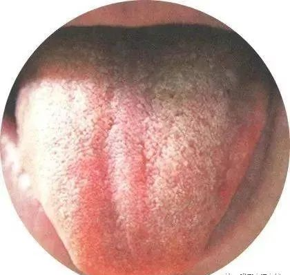 130 High-Definition Tongue Diagnosis Charts (Recommended for Collection)