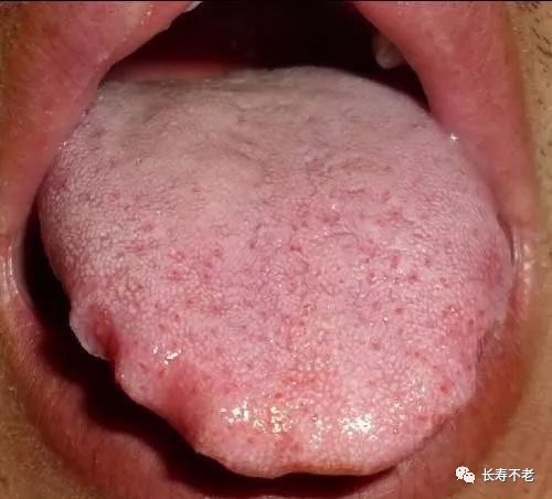 The Most Comprehensive TCM Tongue Diagnosis Atlas: Observe the Tongue, Understand the Whole Body!