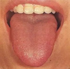 The Health Code Hidden on Your Tongue