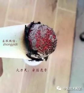 Quick Identification of Kidney Yang Deficiency: Just Four Steps
