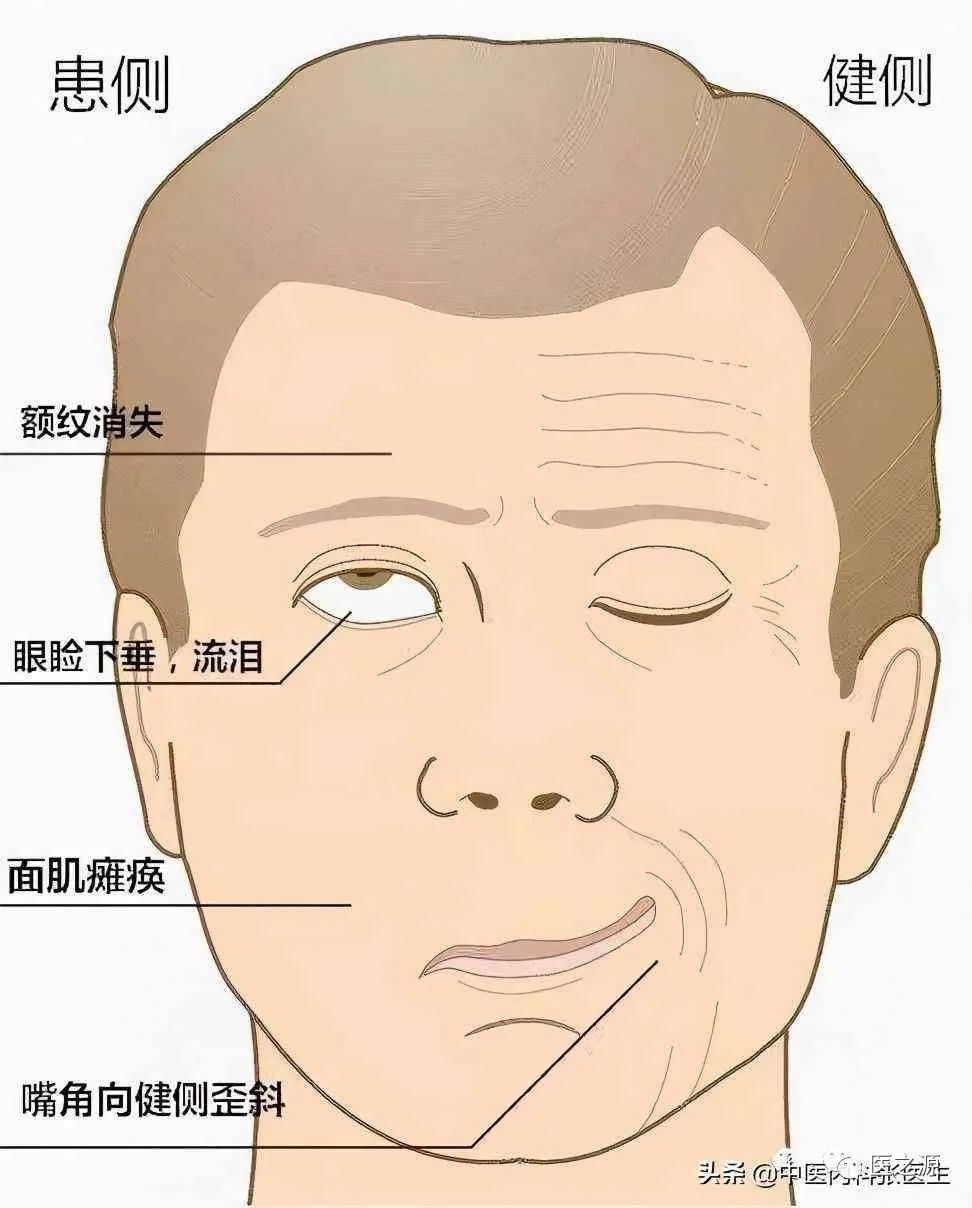 Introduction to Traditional Chinese Medicine: Chapters One and Two of TCM Diagnosis (Introduction and Observation Diagnosis)
