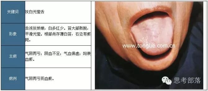 Comprehensive Guide to Tongue Diagnosis (8): 72 Types of Tongue Diagnosis Charts
