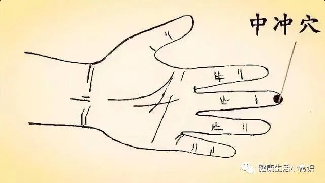 Traditional Chinese Medicine: 10 Acupoints for Healing (Detailed Diagrams), Easy to Learn, Recommended for Collection and Sharing