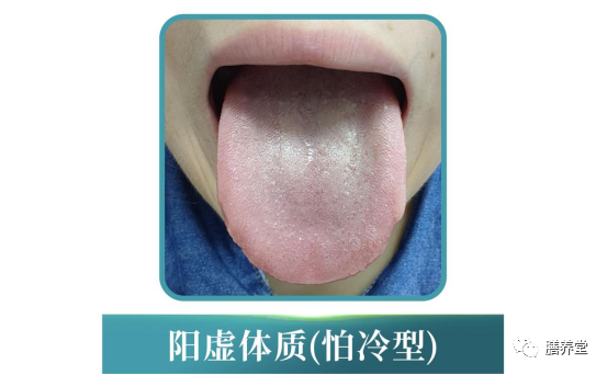 The Nine Constitutions in Traditional Chinese Medicine: Which One Are You?