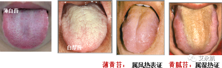 Understanding Disease Through Tongue Diagnosis in Traditional Chinese Medicine
