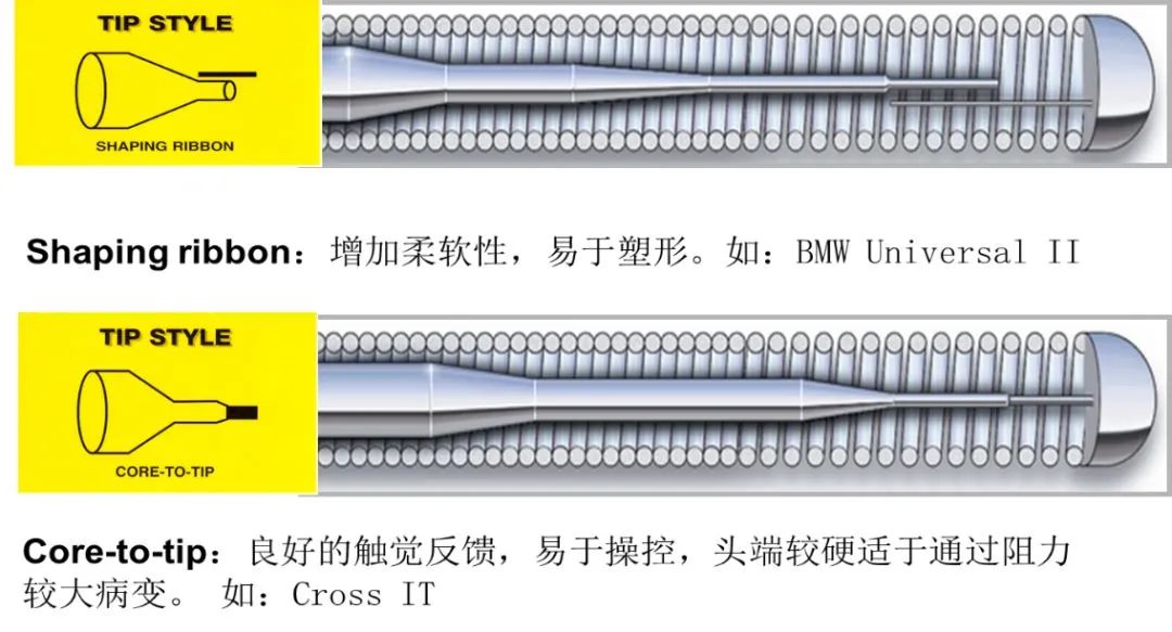 Experience Sharing: Ma Zhimin - The Pioneer of Interventional Therapy
