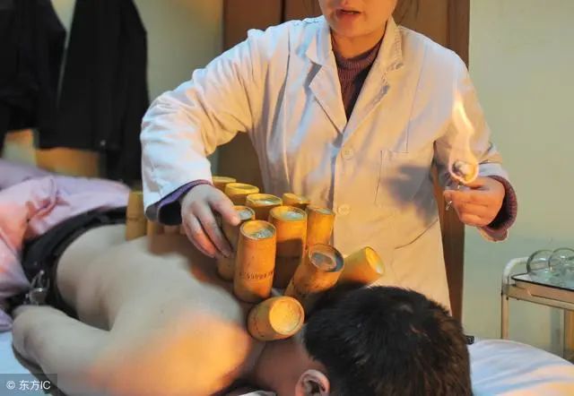 The Art of Cupping in Traditional Chinese Medicine: 5 Contraindications and Analysis of Cupping Marks
