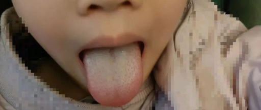 Don't Just Rely on Tongue Coating to Assess Health! There's More to It
