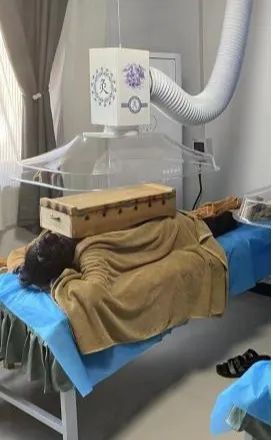 The Unique Therapeutic Approach of Moxibustion in Traditional Chinese Medicine