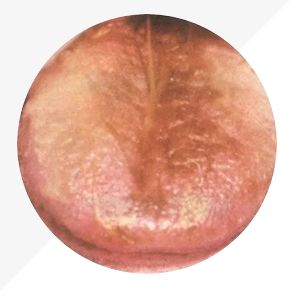 Analysis of High-Definition Tongue Diagnosis Charts: Understanding Health Through Your Tongue (Part 1)