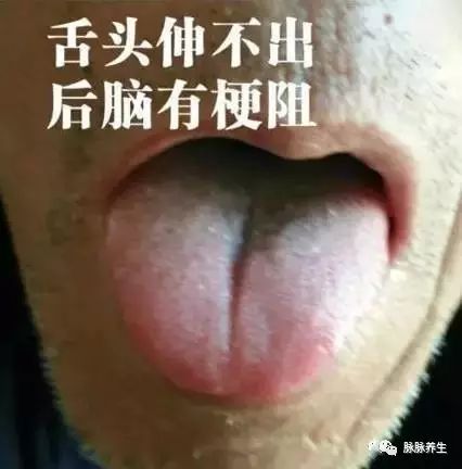 Tongue Diagnosis: A Clear Insight